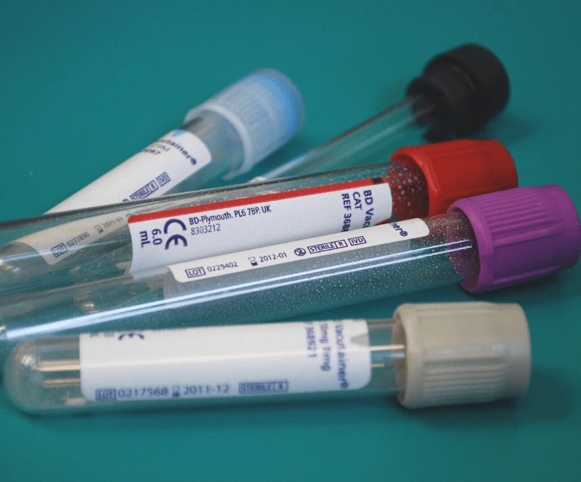 Several empty blood collection tubes with different colored caps—blue, red, purple, gray, and black—are arranged on a teal surface. Each tube has a printed label with medical information and measurement markings.